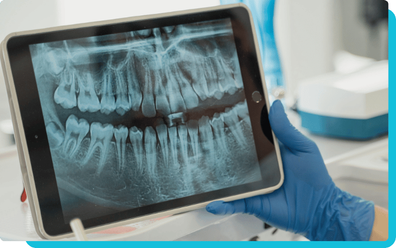 AI dental radiology blog-2