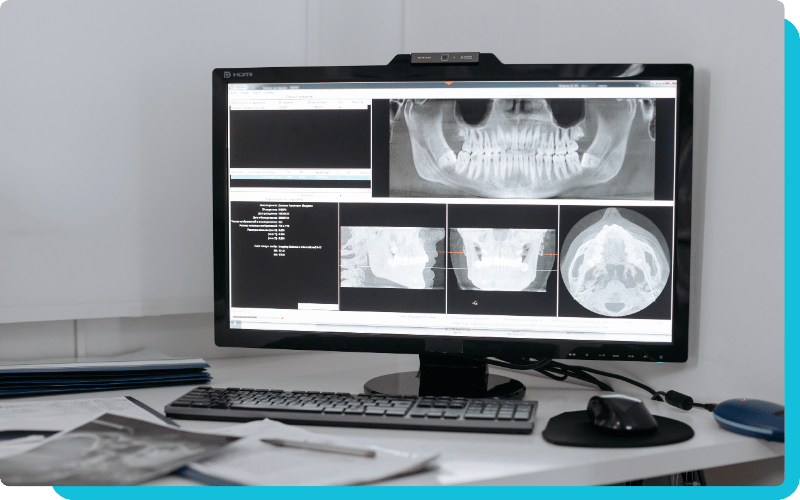 Imaging software