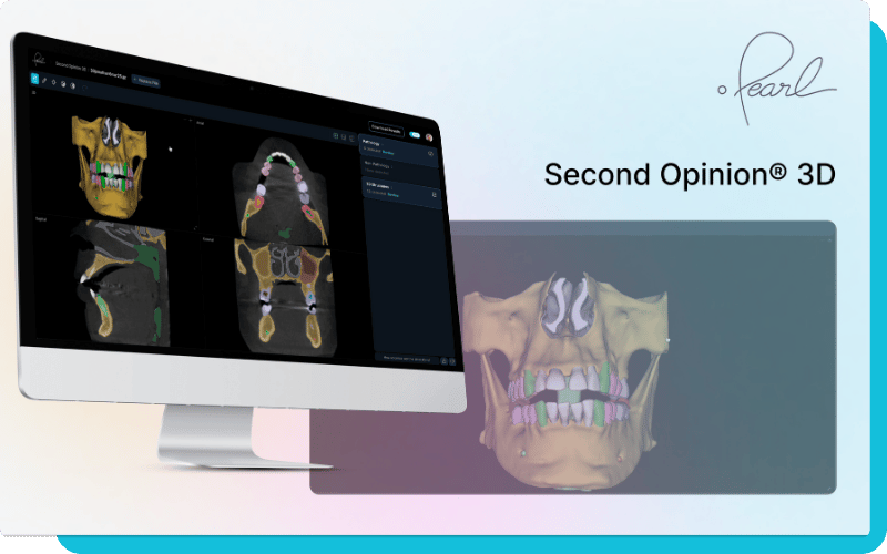 Pearl Second Opinion 3D