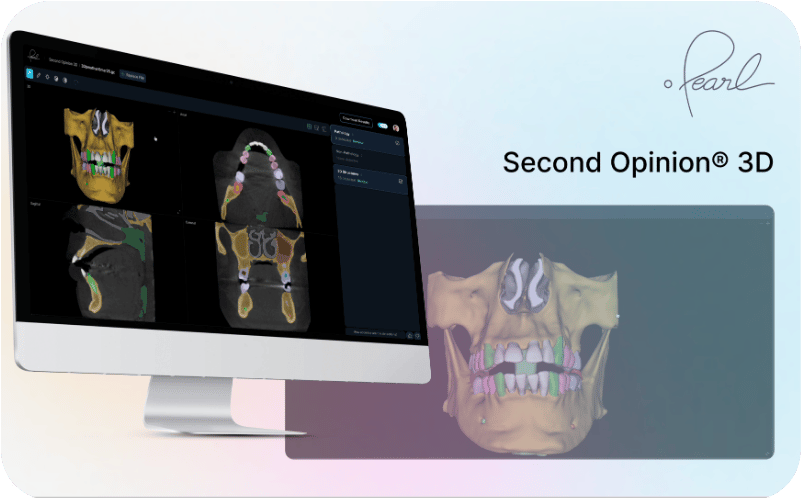 Pearl Second Opinion 3D hero